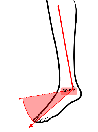 ../_images/goniometer-ankle.png